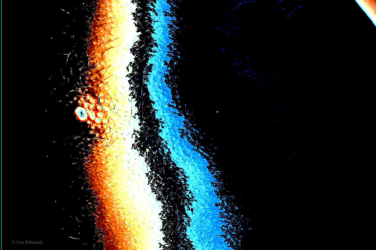 Weltaidstag 2016 © Tom Rübenach